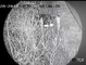 15-kilometrowy laser podczerwieni z kamerą dalekiego zasięgu Obrazowanie termowizyjne z obiektywem o zmiennej ogniskowej